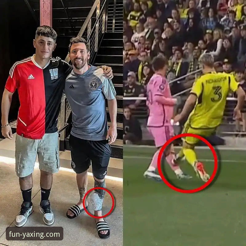 3个关键视角，深度解析阿根廷新星重伤背后的战术与遗憾